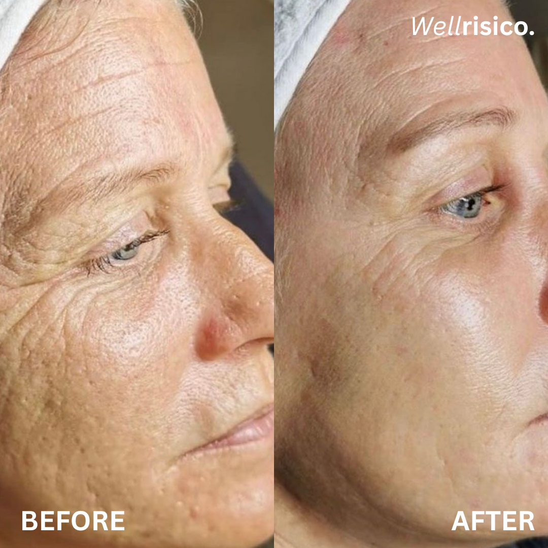 Wellrisico Anti Aging and Total Body Wellness Supplement
