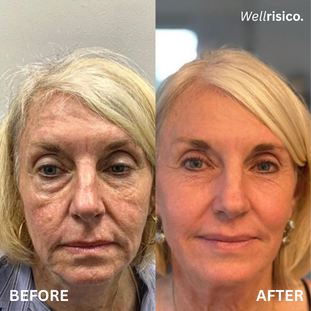 Wellrisico Anti Aging and Total Body Wellness Supplement