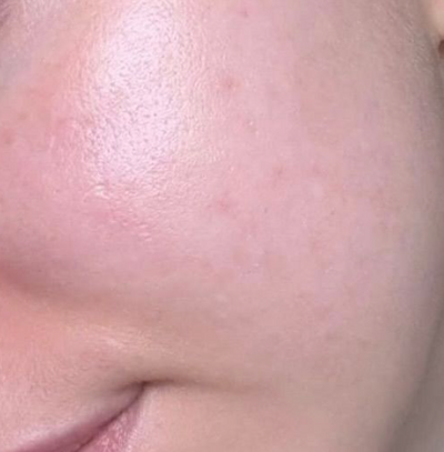 Visible Change Even Skin Tone