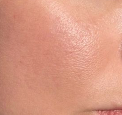 Visible Hydration for Calm, Healthy Skin