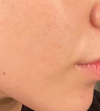 Visible Softness Winter Dryness Gone